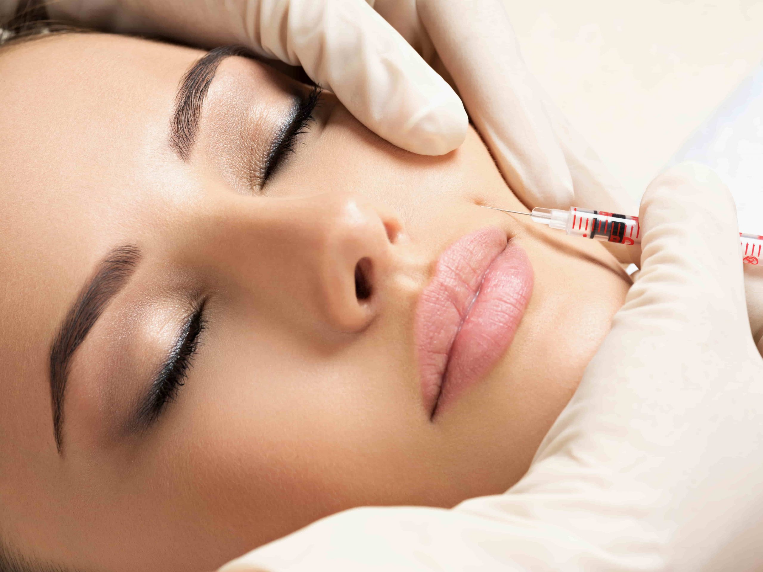 rostro de una mujer inyectándose Botox