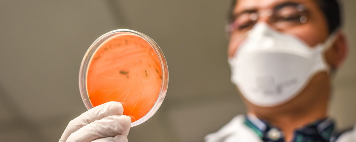 hombre con una muestra de bacterias de la listeria