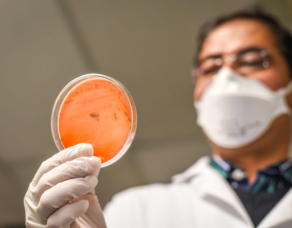 hombre con una muestra de bacterias de la listeria