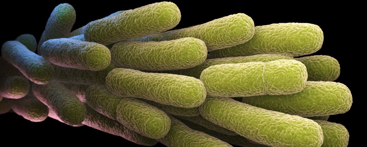 bacterias de color verde representano la Legionella
